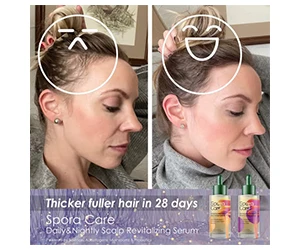 Free Spora Care Scalp Revitalizing Serum – Sign Up Now!
